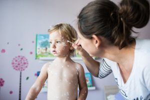 Die Corona-Maßnahmen haben in Münster zu einem starken Rückgang der Windpocken-Fälle geführt, denn Auslöser für Windpocken ist das sogenannte Varizellen-Zoster-Virus, das durch Tröpfcheninfektion über die Luft übertragen wird. (Foto: AOK/hfr)