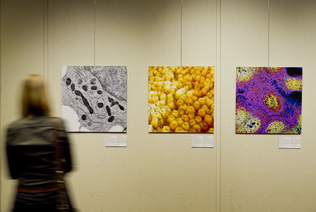 Von mikro bis makro: 27 farbenprächtige Bilder geben Ausstellungsbesuchern Einblicke in das Körperinnere. (Foto: Lichtenscheidt)