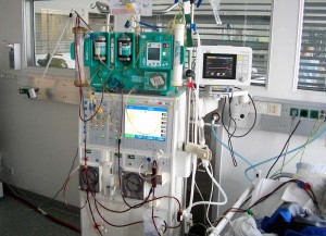 Spezielles Dialyse-Gerät: Mittels des sogenannten MARS-Verfahrens ist es möglich, die Giftstoffe aus dem Blutkreislauf der Patienten zu filtern. (Foto: UKM)
